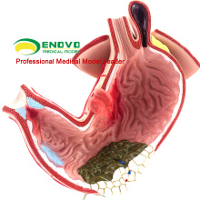 STOMACH04 (12537) Magen-Darm-Modell des menschlichen Magens für medizinische Studie